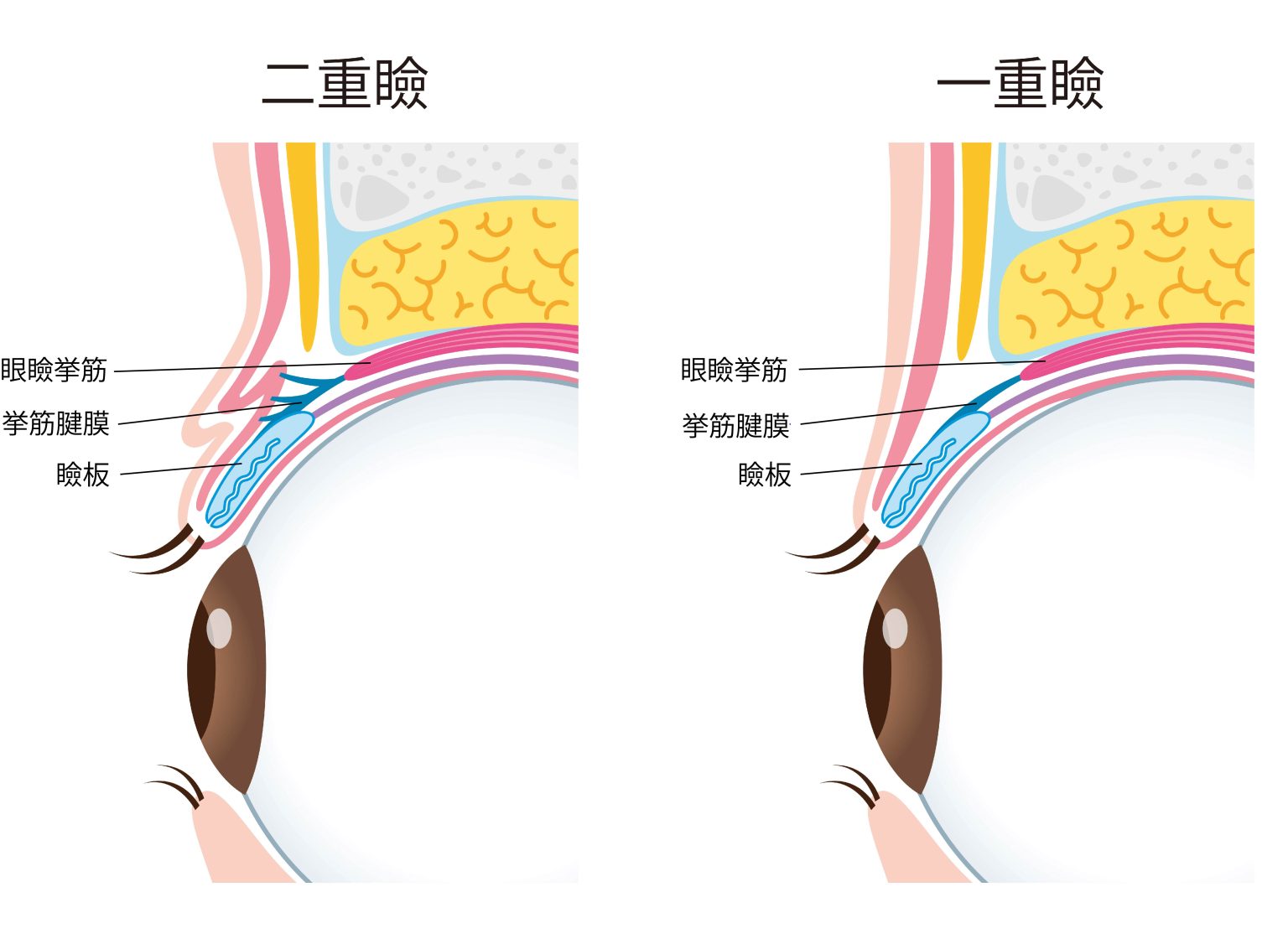 二重と一重の違いについて 二重整形専門のnaru Beauty Clinic ナルクリ