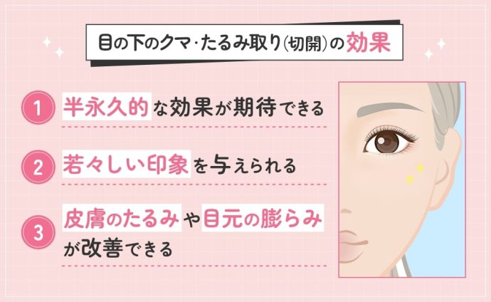 目の下のクマ・たるみ取りの効果