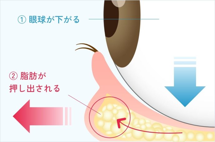 目の下のクマ