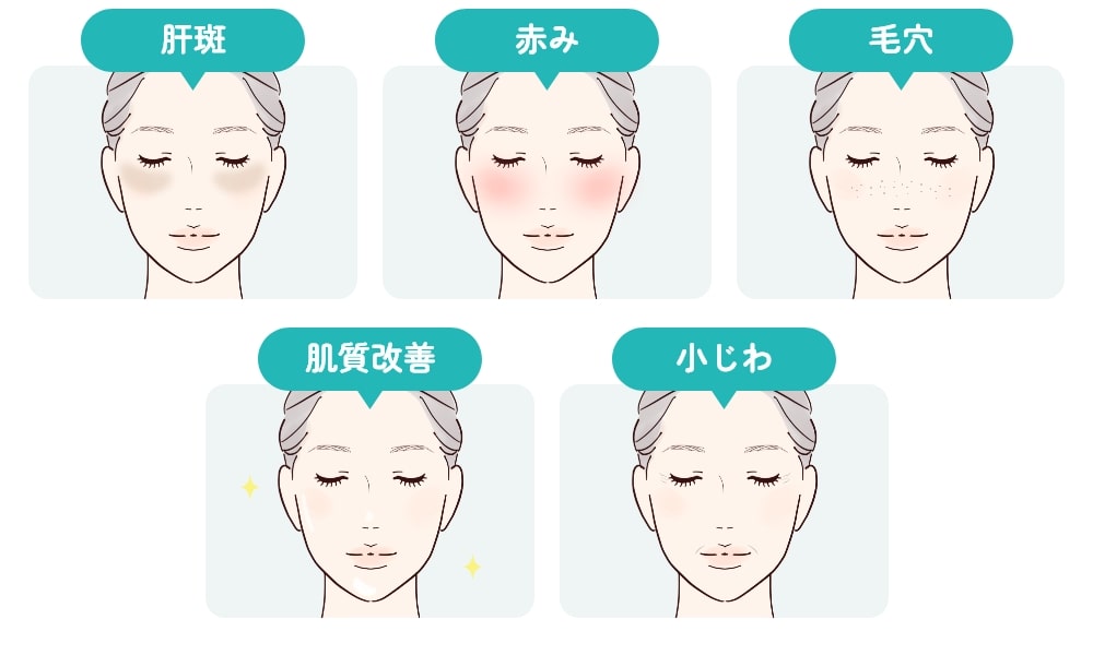 肝斑、赤み、毛穴、肌質改善、小じわでお悩みの方