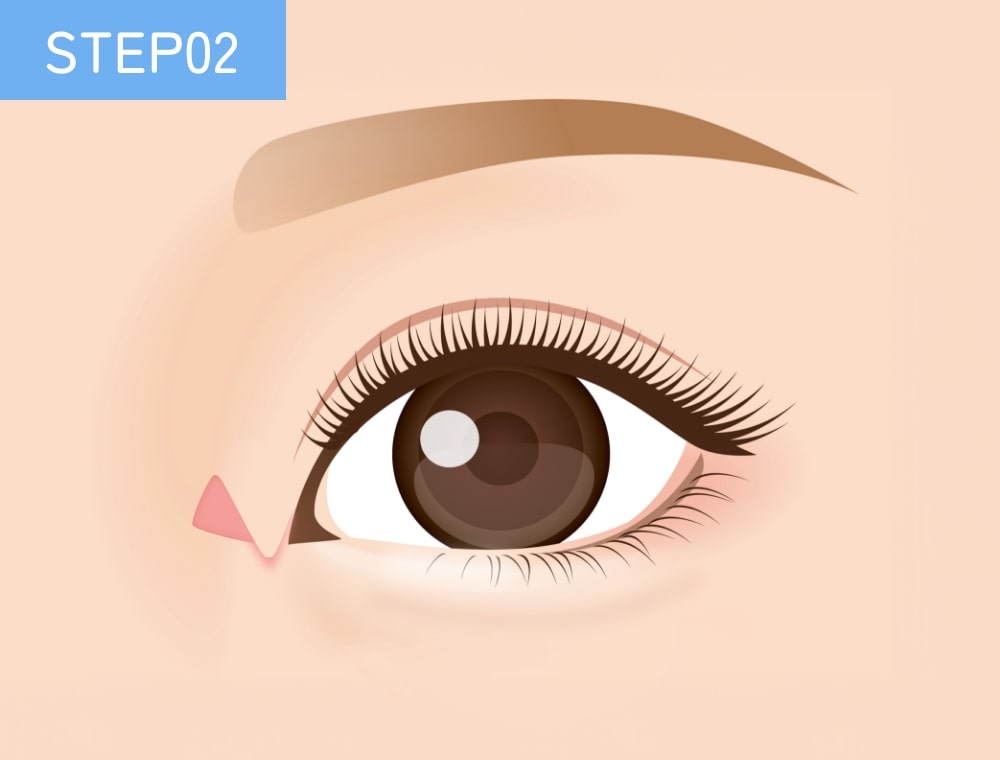 STEP02
