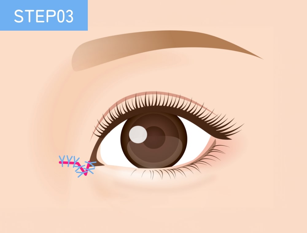 STEP03