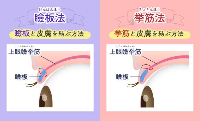 固定点の比較01