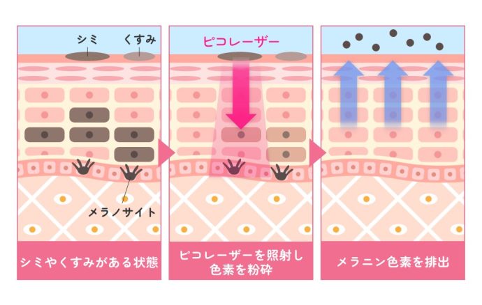 シミやくすみを改善する効果が期待できる