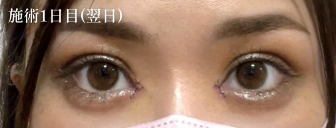 症例写真03
