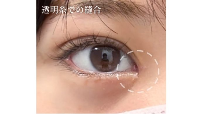 症例写真06