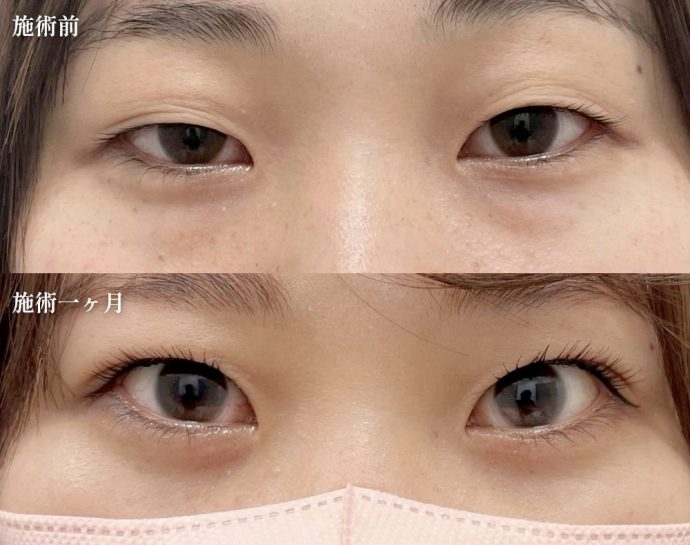 症例写真01