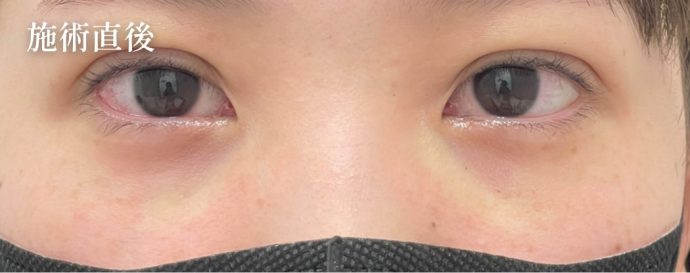 症例写真04