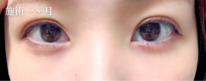 症例写真06