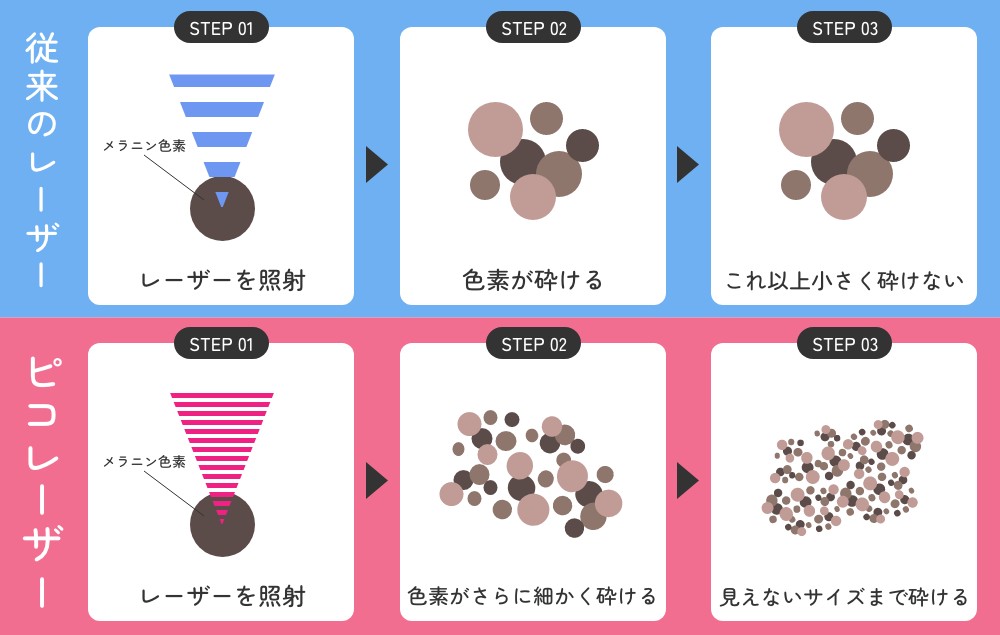 従来のレーザー治療とピコレーザーの違い