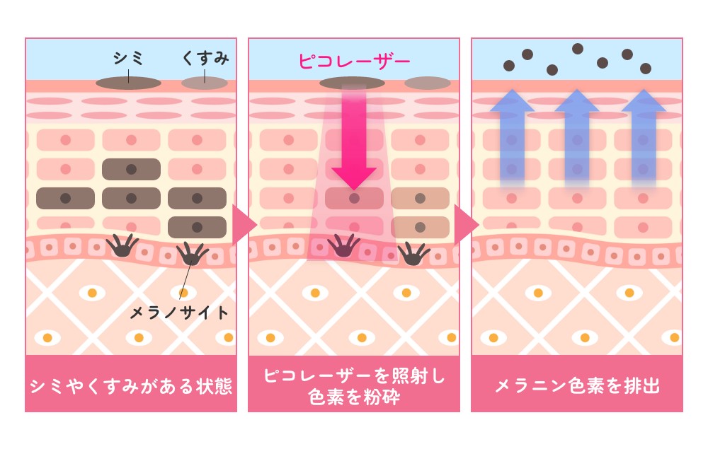 メラニン色素の排出が期待