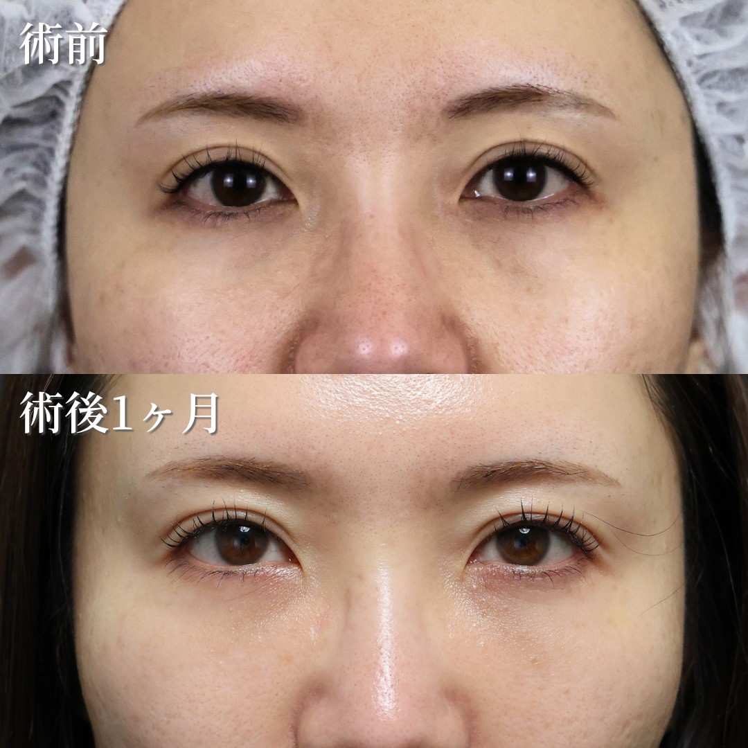 30代女性　裏ハムラ