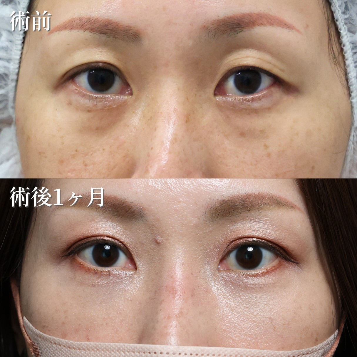 40代女性　裏ハムラ